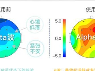 睡眠脑电波检测（科学技术揭开睡眠的神秘面纱）
